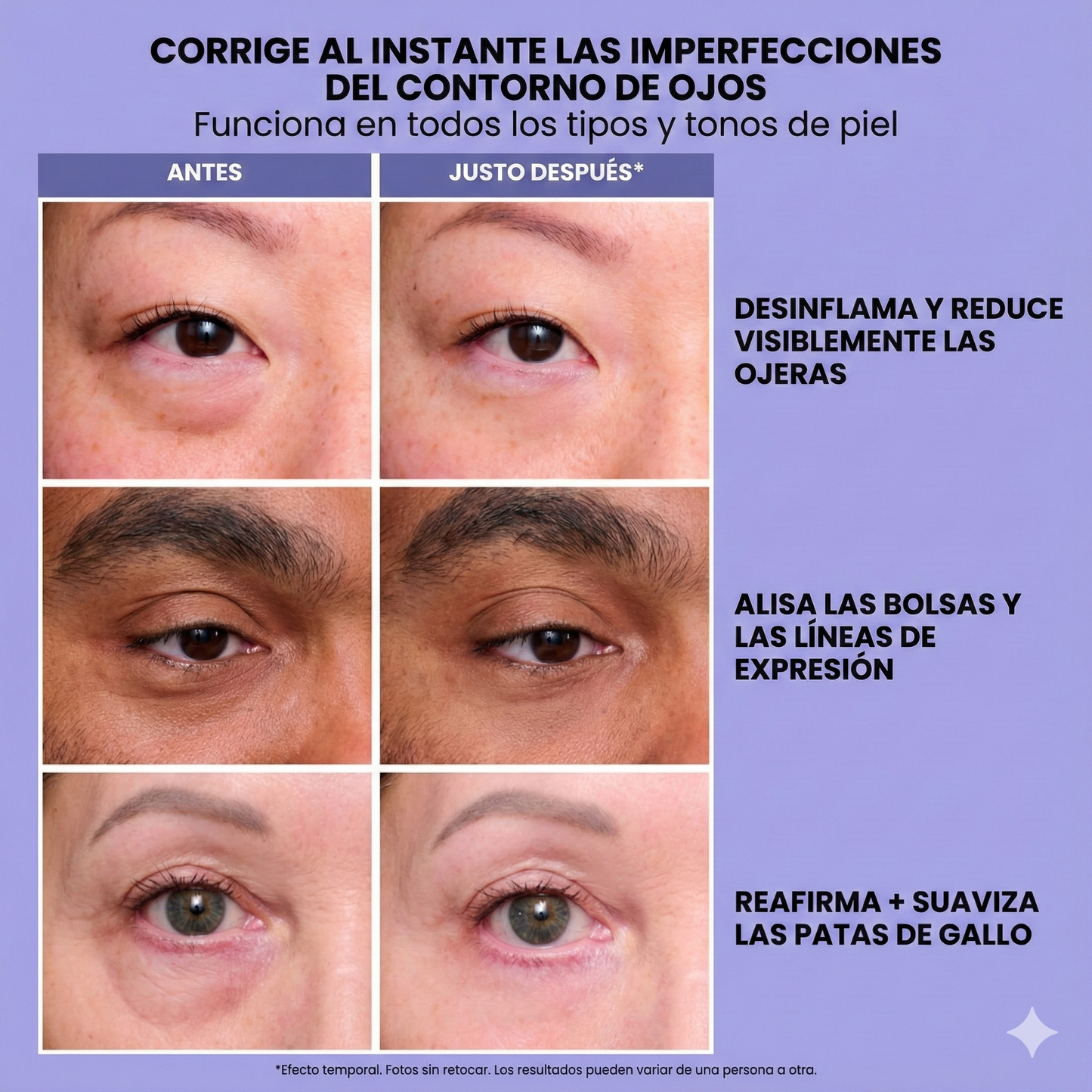 infiniteLift - Gel tensor rejuvenecedor de ojos